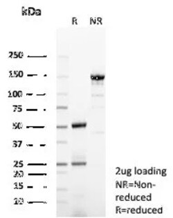 Novus Biologicals GCHFR Antibody (GCHFR/7731), Novus Biologicals:Antibodies:Primary
