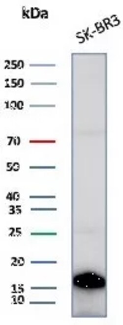 Novus Biologicals GCHFR Antibody (GCHFR/7734), Novus Biologicals:Antibodies:Primary