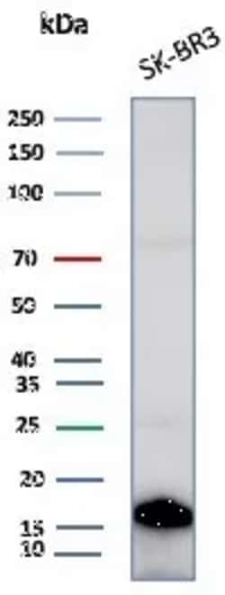 Novus Biologicals GCHFR Antibody (GCHFR/7734), Novus Biologicals:Antibodies:Primary