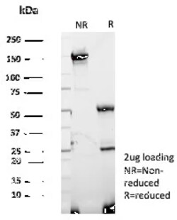 Novus Biologicals GBP1 Antibody (GBP1/7618), Novus Biologicals 100 &mu;g,