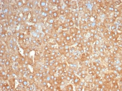 Novus Biologicals Haptoglobin Antibody (HP/3831), Novus Biologicals:Antibodies:Primary