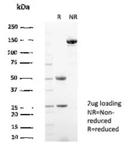 Novus Biologicals HSP90 alpha Antibody (HSP90AA1/7426), Novus Biologicals