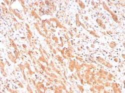 Novus Biologicals Apolipoprotein H/ApoH Antibody (APOH/3682), Novus Biologicals