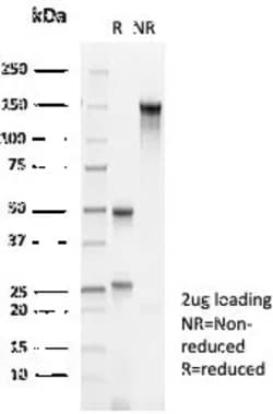 Novus Biologicals Cytokeratin 10 Antibody (KRT10/6961), Novus Biologicals:Antibodies:Primary