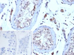 Novus Biologicals LHR Antibody (LHCGR/7398), Novus Biologicals 20 &mu;g,