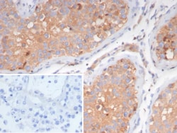 Novus Biologicals LHR Antibody (LHCGR/7399), Novus Biologicals:Antibodies:Primary