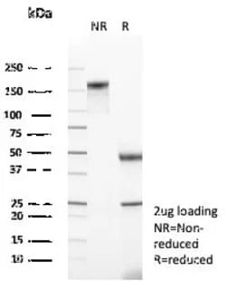 Novus Biologicals Mineralocorticoid R/NR3C2 Antibody (NR3C2/4900), Novus