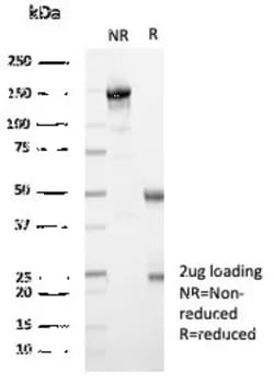 Novus Biologicals MxA/Mx1 Antibody (MX1/7529), Novus Biologicals 100 &mu;g,
