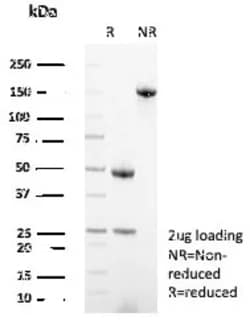 Novus Biologicals MxA/Mx1 Antibody (MX1/7530), Novus Biologicals:Antibodies:Primary