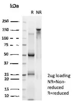 Novus Biologicals n-Myc Antibody (PCRP-MYCN-1A9), Novus Biologicals 100