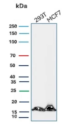 Novus Biologicals NM23-H2/NME2 Antibody (NME2/4160), Novus Biologicals
