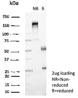 Novus Biologicals NM23-H2/NME2 Antibody (NME2/4160), Novus Biologicals