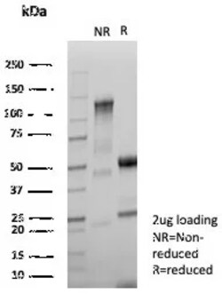Novus Biologicals NM23-H2/NME2 Antibody (NME2/6433), Novus Biologicals