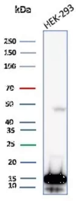 Novus Biologicals NM23-H2/NME2 Antibody (NME2/6434), Novus Biologicals:Antibodies:Primary