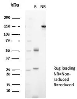 Novus Biologicals NM23-H2/NME2 Antibody (NME2/6434), Novus Biologicals:Antibodies:Primary