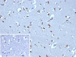 Novus Biologicals Neurogenin-3 Antibody (NGN3/1808), Novus Biologicals:Antistoffer:Primære