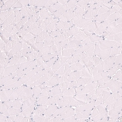Novus Biologicals LAG-3 Antibody (CL14773), Novus Biologicals:Antibodies:Primary