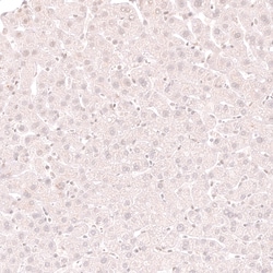 Novus Biologicals Lactase Antibody (CL14133), Novus Biologicals 100 &mu;L;