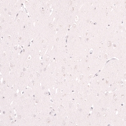 Novus Biologicals Lactase Antibody (CL14133), Novus Biologicals 100 &mu;L;