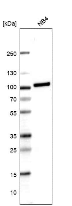 Novus Biologicals Myeloperoxidase/MPO Antibody (CL14991), Novus Biologicals
