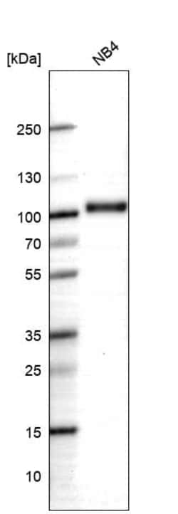 Novus Biologicals Myeloperoxidase/MPO Antibody (CL15002), Novus Biologicals:Antibodies:Primary
