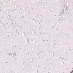 Novus Biologicals Myeloperoxidase/MPO Antibody (CL15002), Novus Biologicals:Antibodies:Primary