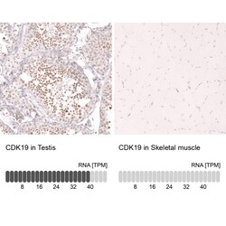 Novus Biologicals CDC2L6 Antibody (CL14116), Novus Biologicals 25 &mu;L;