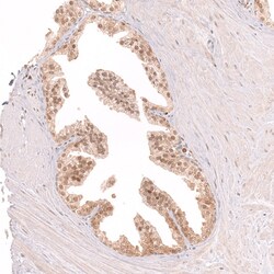 Novus Biologicals CDC2L6 Antibody (CL14116), Novus Biologicals 25 &mu;L;