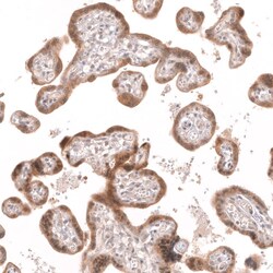 Novus Biologicals R-Spondin 2 Antibody (CL14321), Novus Biologicals 100