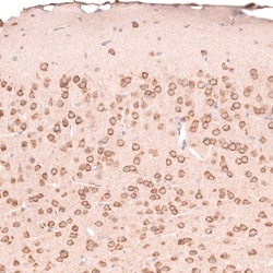 Novus Biologicals R-Spondin 2 Antibody (CL14321), Novus Biologicals 100