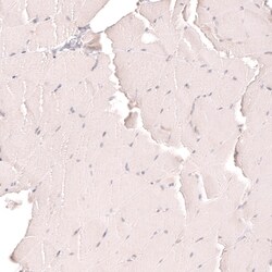 Novus Biologicals R-Spondin 2 Antibody (CL14321), Novus Biologicals 100