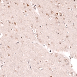 Novus Biologicals R-Spondin 2 Antibody (CL14321), Novus Biologicals 100