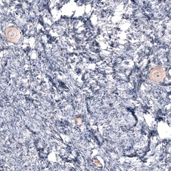 Novus Biologicals R-Spondin 2 Antibody (CL14321), Novus Biologicals 100