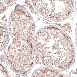 Novus Biologicals Porimin Antibody (CL14381), Novus Biologicals 100 &mu;L;