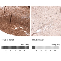 Novus Biologicals TFEB Antibody (CL14112), Novus Biologicals 100 &mu;L;