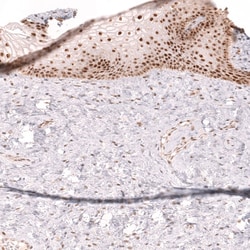 Novus Biologicals TFEB Antibody (CL14112), Novus Biologicals 100 &mu;L;