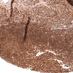 Novus Biologicals TFEB Antibody (CL14112), Novus Biologicals 100 &mu;L;