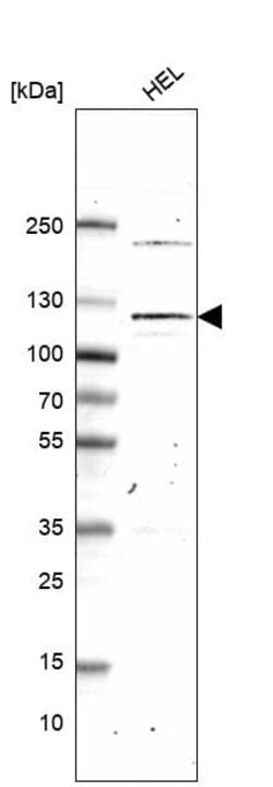Novus Biologicals PMS1 Antibody (CL14436), Novus Biologicals 25 &mu;L;