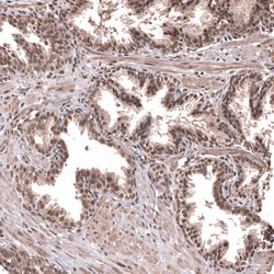 Novus Biologicals PRRX1 Antibody (CL14471), Novus Biologicals 25 &mu;L;