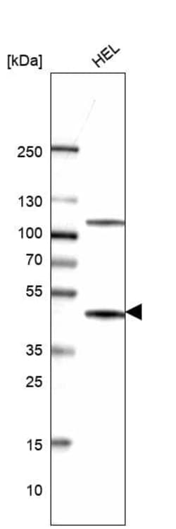 Novus Biologicals TYKi Antibody (CL14479), Novus Biologicals:Antibodies:Primary