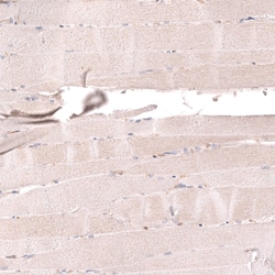 Novus Biologicals TYKi Antibody (CL14479), Novus Biologicals:Antibodies:Primary