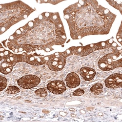 Novus Biologicals TYKi Antibody (CL14479), Novus Biologicals:Antibodies:Primary