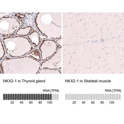 Novus Biologicals TTF-1/ NKX2-1 Antibody (CL14523), Novus Biologicals 25