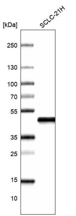 Novus Biologicals TTF-1/ NKX2-1 Antibody (CL14523), Novus Biologicals 25