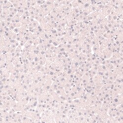 Novus Biologicals TTF-1/ NKX2-1 Antibody (CL14523), Novus Biologicals 25