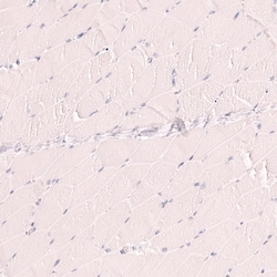 Novus Biologicals TTF-1/ NKX2-1 Antibody (CL14523), Novus Biologicals 25