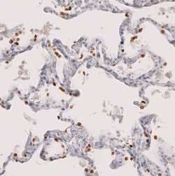 Novus Biologicals TTF-1/ NKX2-1 Antibody (CL14531), Novus Biologicals 100