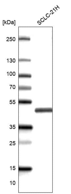 Novus Biologicals TTF-1/ NKX2-1 Antibody (CL14531), Novus Biologicals 100