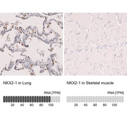Novus Biologicals TTF-1/ NKX2-1 Antibody (CL14531), Novus Biologicals 100