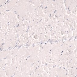 Novus Biologicals TTF-1/ NKX2-1 Antibody (CL14531), Novus Biologicals 100
